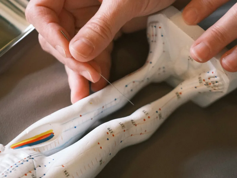 Acupuncture at Locke Chiropractic & Rehabilitation Center in Winston-Salem