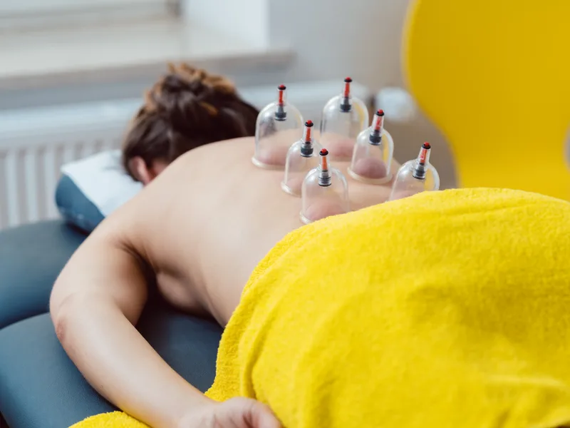 Cupping Therapy at Locke Chiropractic & Rehabilitation Center in Winston-Salem