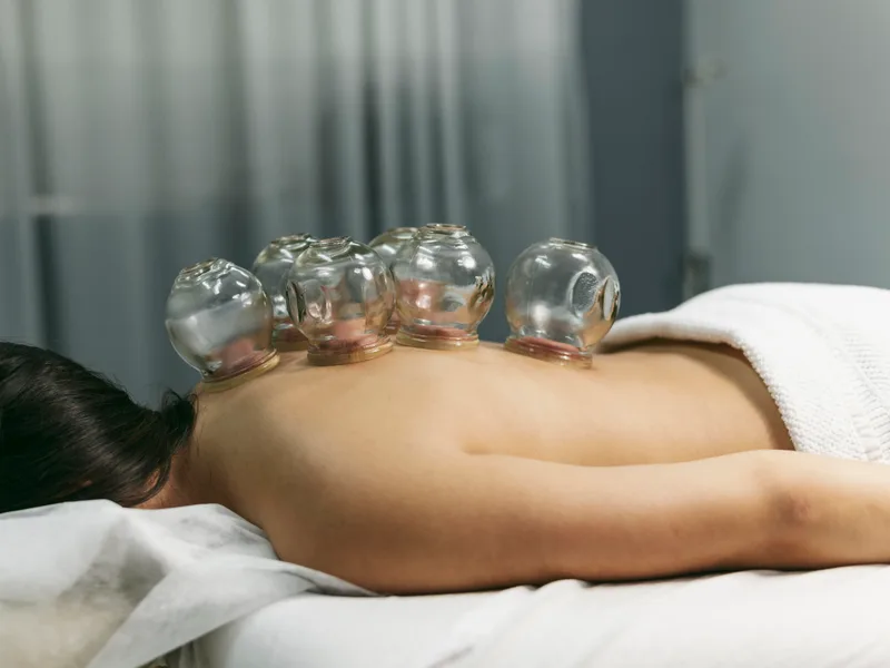 Cupping Therapy at Locke Chiropractic & Rehabilitation Center in Winston-Salem